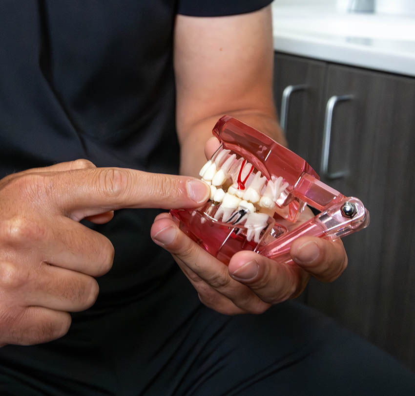 PeriodontalModel-Square-NH-01